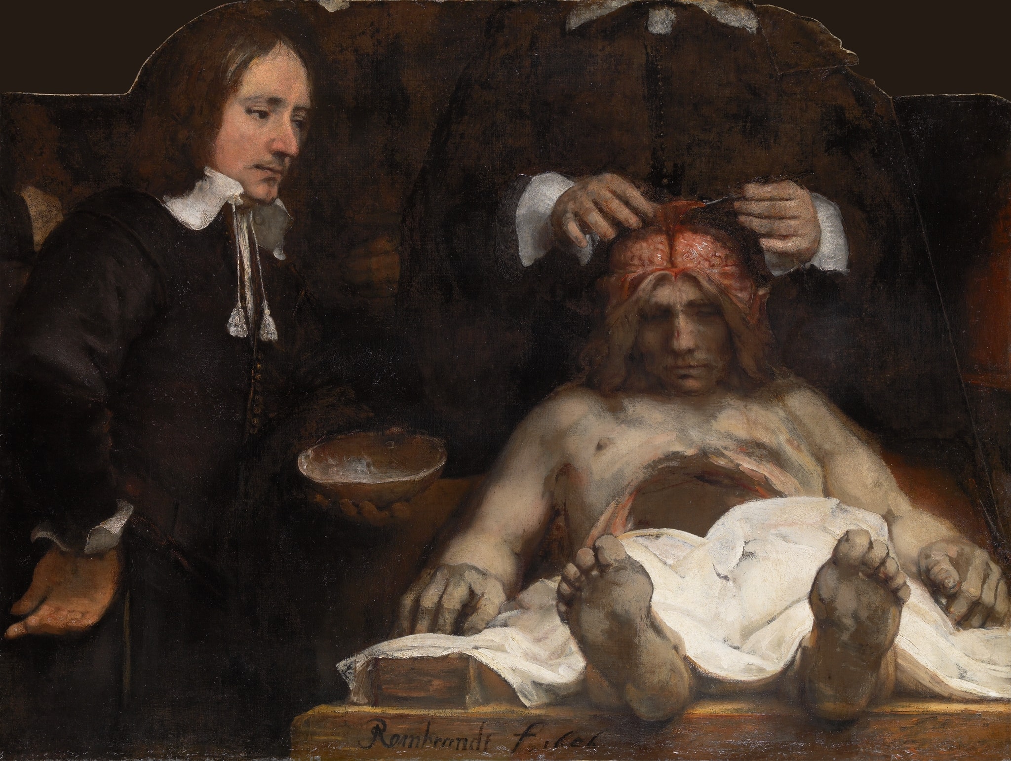 Click numbered symbols to learn about their meaning The Anatomy Lesson of Dr. Jan Deijman by Rembrandt van Rijn (1656) featuring Falx cerebri, White sheet, Foreshortened soles of the feet, Surgical instruments and cuffed hands